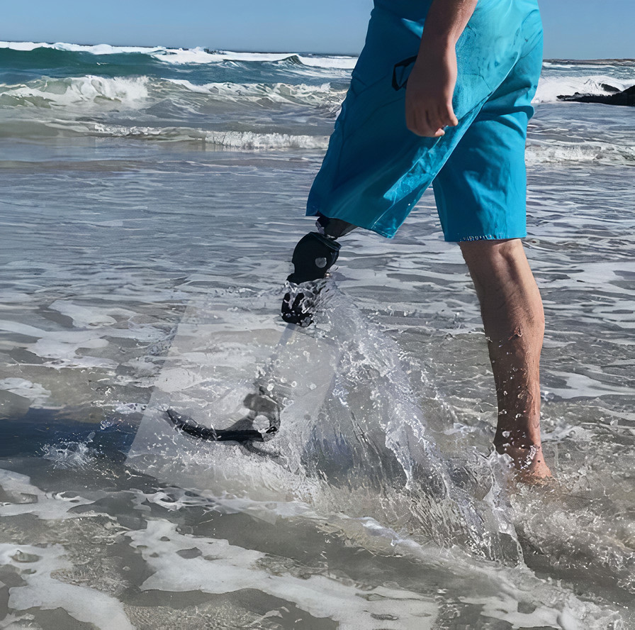 WEIGEL+ medical found that BUMAX was the only screw on the market capable of providing a prosthetic knee joint with the necessary high strength and corrosion resistance.